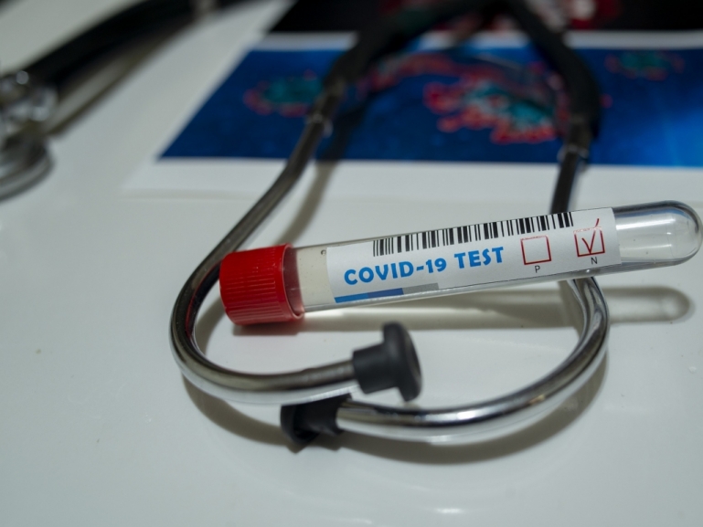 COVID, CONTRIBUTO ALLE STRUTTURE PRIVATE ACCREDITATE: APPROVATE LE LINEE GUIDA PER LE ASL