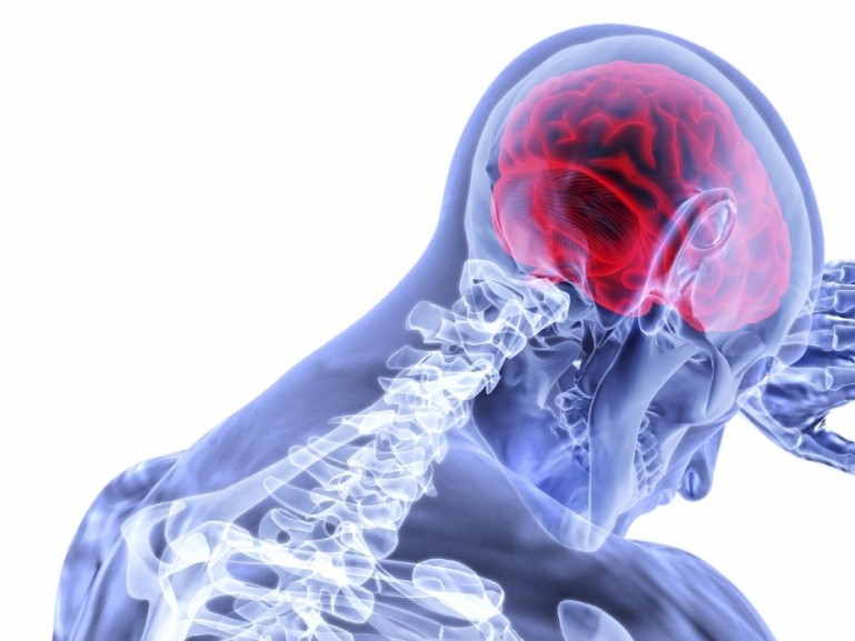 Sanità, parte la “Rete Stroke” per i pazienti colpiti da ictus